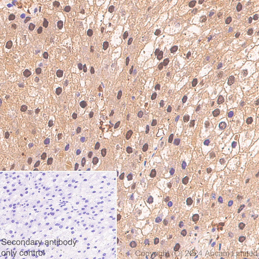 Immunohistochemistry (Formalin/PFA-fixed paraffin-embedded sections) - Anti-PSMB5/MB1 antibody [EPR28990-5] (AB321797)