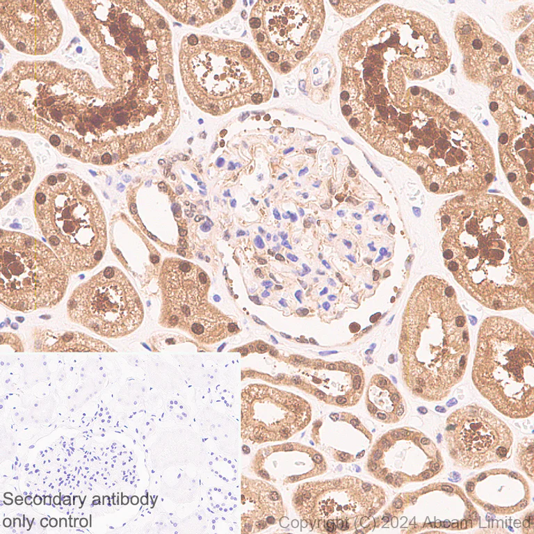 Immunohistochemistry (Formalin/PFA-fixed paraffin-embedded sections) - Anti-PSMB5/MB1 antibody [EPR28990-5] - BSA and Azide free (AB321798)