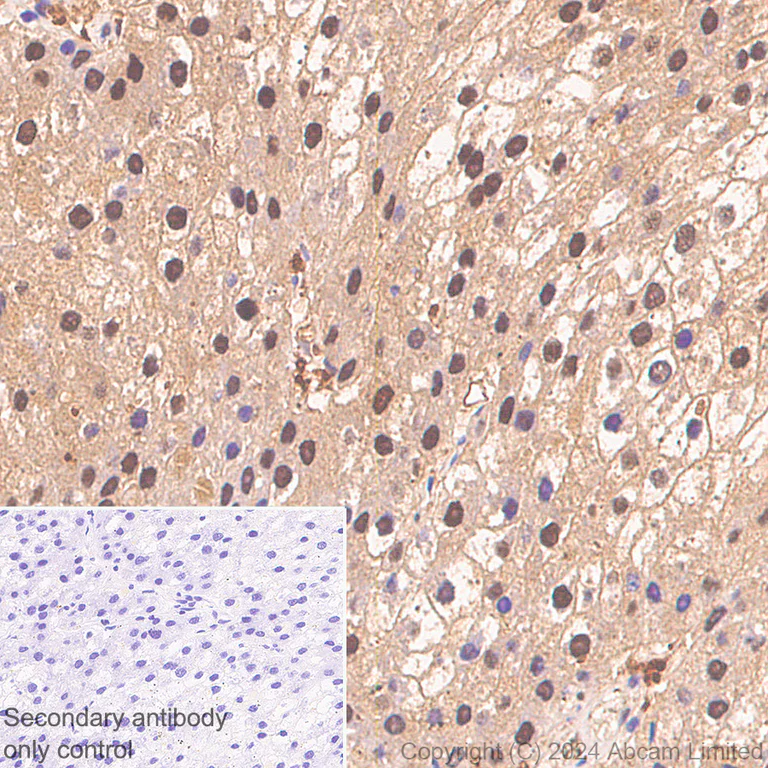 Immunohistochemistry (Formalin/PFA-fixed paraffin-embedded sections) - Anti-PSMB5/MB1 antibody [EPR28990-5] - BSA and Azide free (AB321798)