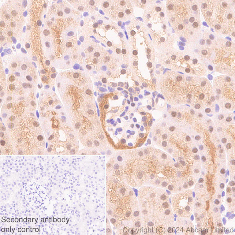 Immunohistochemistry (Formalin/PFA-fixed paraffin-embedded sections) - Anti-PSMB5/MB1 antibody [EPR28990-5] - BSA and Azide free (AB321798)
