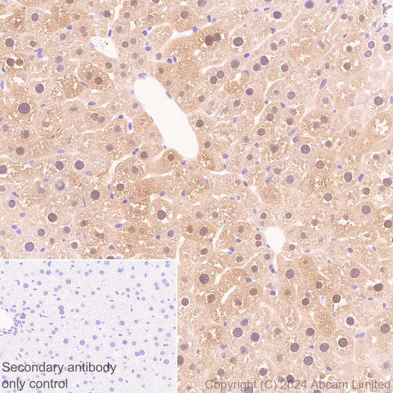 Immunohistochemistry (Formalin/PFA-fixed paraffin-embedded sections) - Anti-PSMB5/MB1 antibody [EPR28990-5] - BSA and Azide free (AB321798)