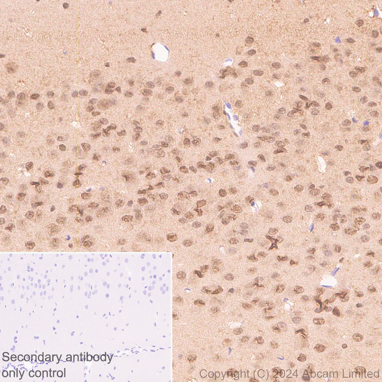 Immunohistochemistry (Formalin/PFA-fixed paraffin-embedded sections) - Anti-PSMB5/MB1 antibody [EPR28990-5] - BSA and Azide free (AB321798)
