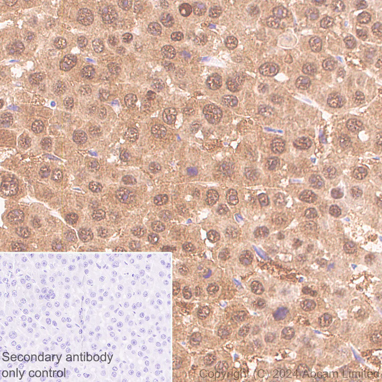 Immunohistochemistry (Formalin/PFA-fixed paraffin-embedded sections) - Anti-PSMB5/MB1 antibody [EPR28990-5] - BSA and Azide free (AB321798)