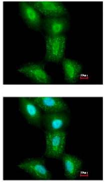 Immunocytochemistry/ Immunofluorescence - Anti-PSMC5 antibody (AB137476), expandable thumbnail