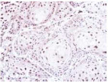 Immunohistochemistry (Formalin/PFA-fixed paraffin-embedded sections) - Anti-PSMC5 antibody (AB137476), expandable thumbnail