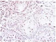 Immunohistochemistry (Formalin/PFA-fixed paraffin-embedded sections) - Anti-PSMC5 antibody (AB137476)