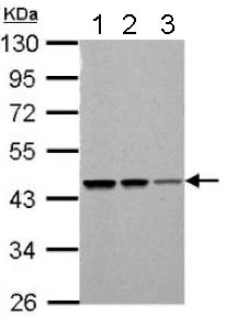 Western blot - Anti-PSMC5 antibody (AB137476), expandable thumbnail