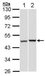 Western blot - Anti-PSMC5 antibody (AB137476)