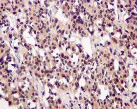 Immunohistochemistry (Formalin/PFA-fixed paraffin-embedded sections) - Anti-PSMC5 antibody [EPR13565(B)] - BSA and Azide free (AB240208)