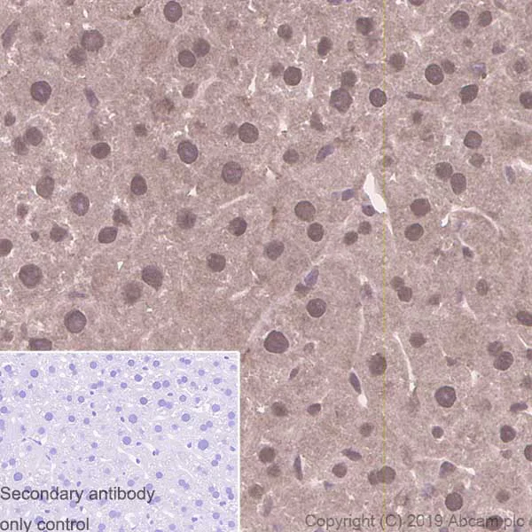 Immunohistochemistry (Formalin/PFA-fixed paraffin-embedded sections) - Anti-PSMC5 antibody [EPR13565(B)] - BSA and Azide free (AB240208)