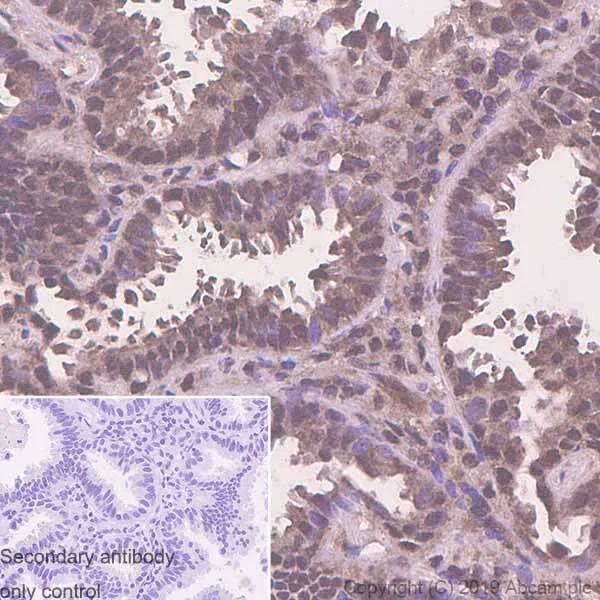 Immunohistochemistry (Formalin/PFA-fixed paraffin-embedded sections) - Anti-PSMC5 antibody [EPR13565(B)] - BSA and Azide free (AB240208)