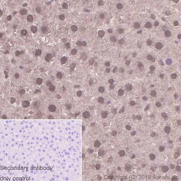 Immunohistochemistry (Formalin/PFA-fixed paraffin-embedded sections) - Anti-PSMC5 antibody [EPR13565(B)] - BSA and Azide free (AB240208)