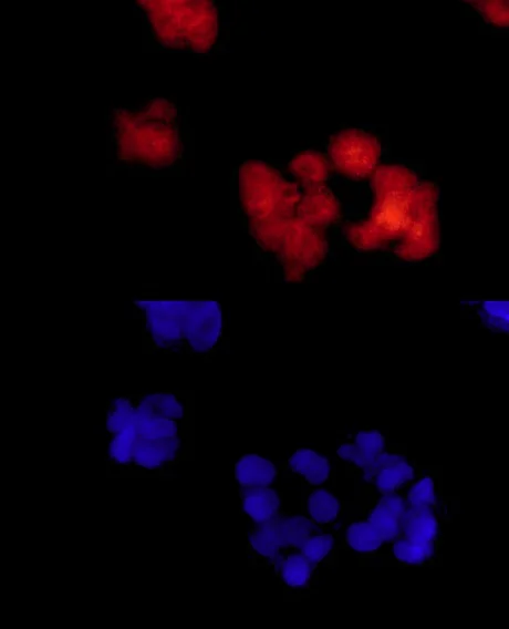 Immunocytochemistry/ Immunofluorescence - Anti-PSMC5 antibody [EPR13566(B)] - BSA and Azide free (AB250198)