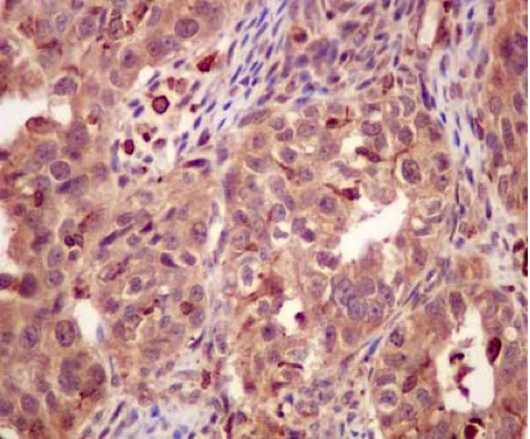 Immunohistochemistry (Formalin/PFA-fixed paraffin-embedded sections) - Anti-PSMC5 antibody [EPR13566(B)] - C-terminal (AB180495)