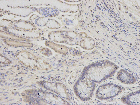 Immunohistochemistry (Formalin/PFA-fixed paraffin-embedded sections) - Anti-PSMC6 antibody (AB186858)