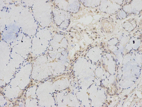 Immunohistochemistry (Formalin/PFA-fixed paraffin-embedded sections) - Anti-PSMC6 antibody (AB186858)