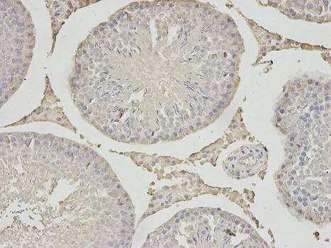 Immunohistochemistry (Formalin/PFA-fixed paraffin-embedded sections) - Anti-PSMC6 antibody (AB186858)