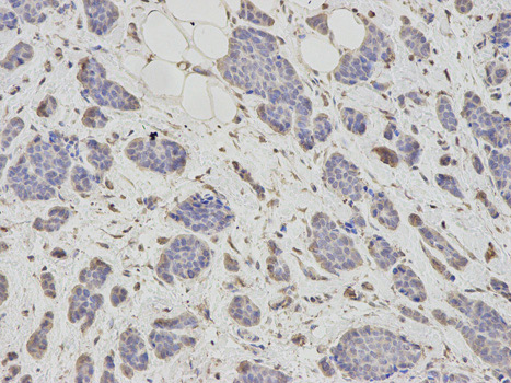 Immunohistochemistry (Formalin/PFA-fixed paraffin-embedded sections) - Anti-PSMC6 antibody (AB186858)