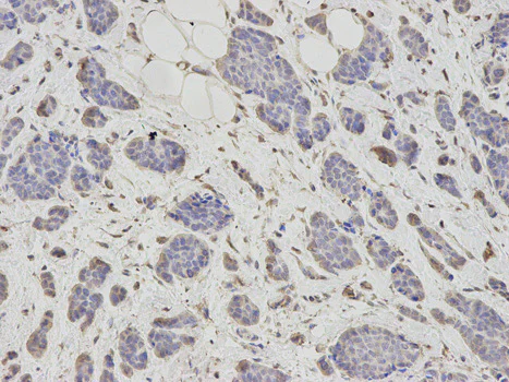 Immunohistochemistry (Formalin/PFA-fixed paraffin-embedded sections) - Anti-PSMC6 antibody (AB186858)