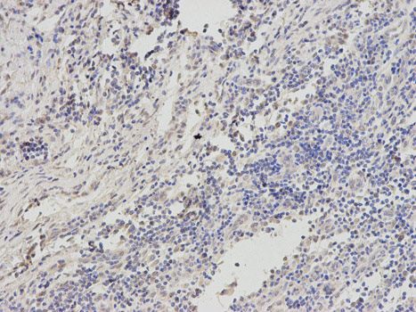 Immunohistochemistry (Formalin/PFA-fixed paraffin-embedded sections) - Anti-PSMC6 antibody (AB186858)