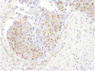 Immunohistochemistry (Frozen sections) - Anti-PSMD1 antibody (AB140682)