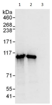 Immunoprecipitation - Anti-PSMD1 antibody (AB140682)