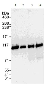 Western blot - Anti-PSMD1 antibody (AB140682)