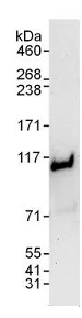 Western blot - Anti-PSMD1 antibody (AB140682)