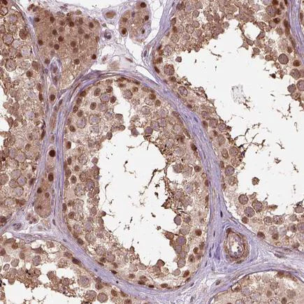 Immunohistochemistry (Formalin/PFA-fixed paraffin-embedded sections) - Anti-PSMD11 antibody (AB221645)