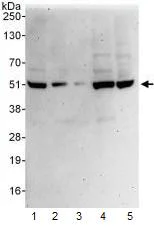 Western blot - Anti-PSMD11 antibody (AB99413)
