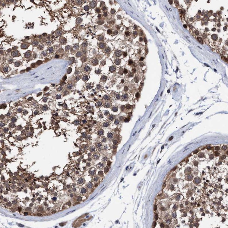 Immunohistochemistry (Formalin/PFA-fixed paraffin-embedded sections) - Anti-PSMD12 antibody (AB246940)