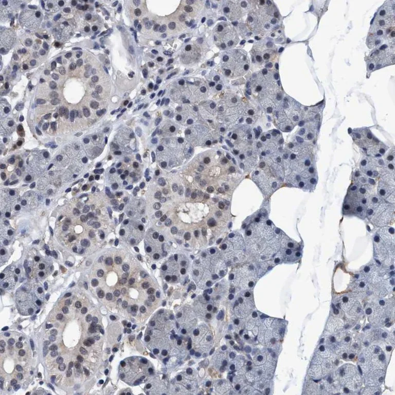 Immunohistochemistry (Formalin/PFA-fixed paraffin-embedded sections) - Anti-PSMD12 antibody (AB246940)