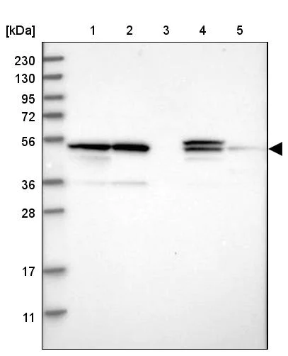 Western blot - Anti-PSMD12 antibody (AB246940)