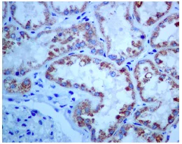 Immunohistochemistry (Formalin/PFA-fixed paraffin-embedded sections) - Anti-PSMD13 antibody [EPR8525] (AB131054)