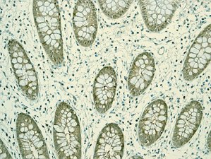 Anti-PSMD14 antibody [EPR4257]