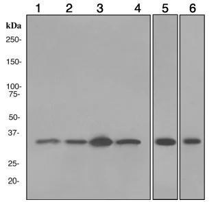 Western blot - Anti-PSMD14 antibody [EPR4257] (AB109123)