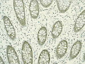 Immunohistochemistry (Formalin/PFA-fixed paraffin-embedded sections) - Anti-PSMD14 antibody [EPR4257] - BSA and Azide free (AB247771)