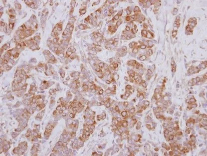 Immunohistochemistry (Formalin/PFA-fixed paraffin-embedded sections) - Anti-PSMD5 antibody (AB137733)