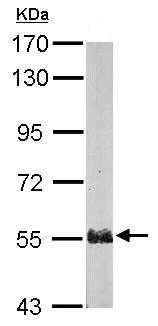 Western blot - Anti-PSMD5 antibody (AB137733)