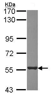 Western blot - Anti-PSMD5 antibody (AB137733)