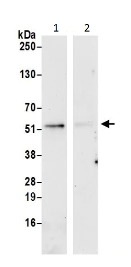 Immunoprecipitation - Anti-PSMD5 antibody (AB226371)