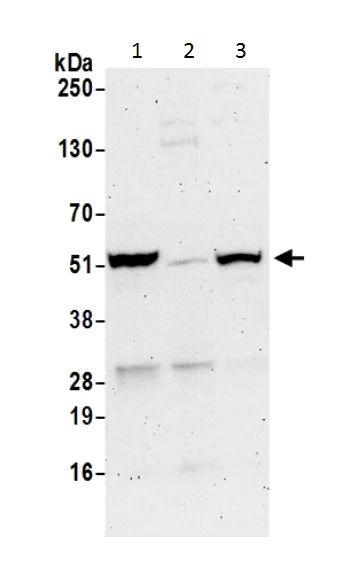Western blot - Anti-PSMD5 antibody (AB226371)