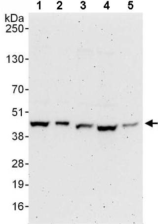 Western blot - Anti-PSMD6 antibody (AB140461)
