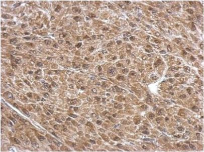 Immunohistochemistry (Formalin/PFA-fixed paraffin-embedded sections) - Anti-PSMD6 antibody (AB155761), expandable thumbnail