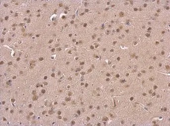 Immunohistochemistry (Formalin/PFA-fixed paraffin-embedded sections) - Anti-PSMD6 antibody (AB155761)
