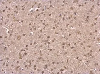 Immunohistochemistry (Formalin/PFA-fixed paraffin-embedded sections) - Anti-PSMD6 antibody (AB155761)