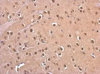 Immunohistochemistry (Formalin/PFA-fixed paraffin-embedded sections) - Anti-PSMD6 antibody (AB155761)