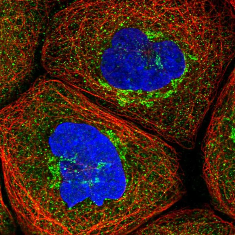 Immunocytochemistry/ Immunofluorescence - Anti-PSMD6 antibody (AB247004)