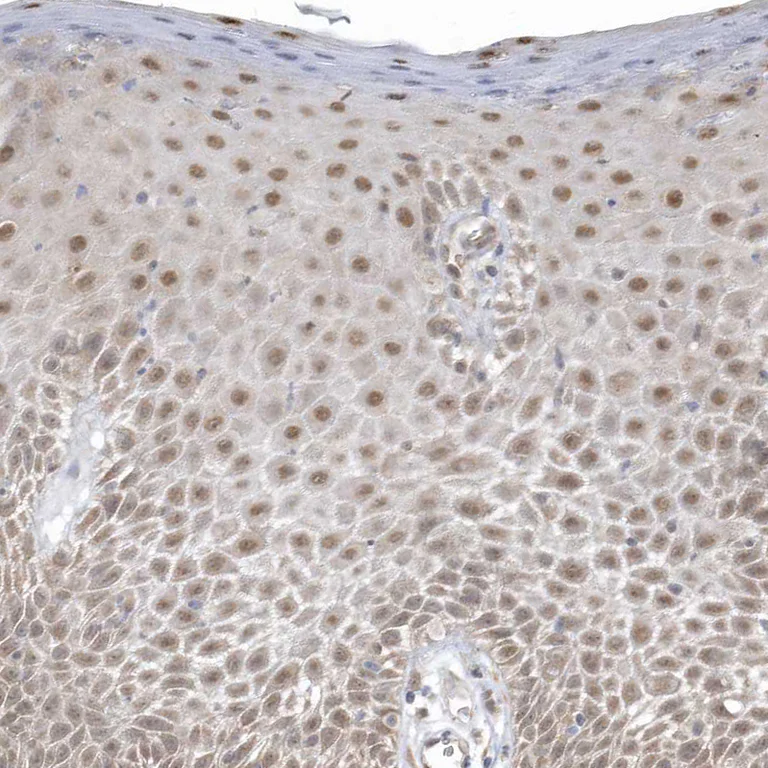Immunohistochemistry (Formalin/PFA-fixed paraffin-embedded sections) - Anti-PSMD6 antibody (AB247004)