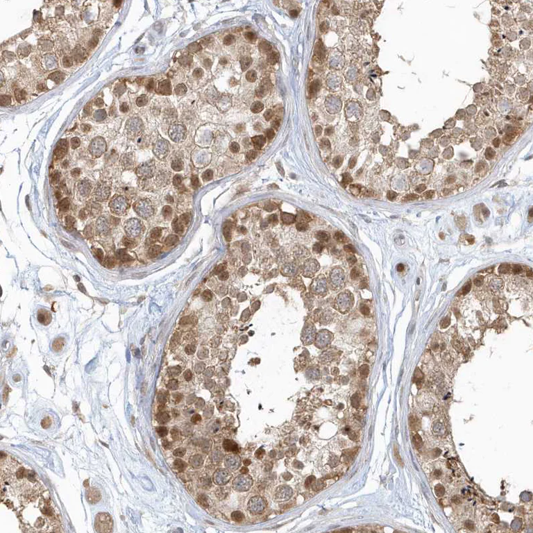 Immunohistochemistry (Formalin/PFA-fixed paraffin-embedded sections) - Anti-PSMD6 antibody (AB247004)